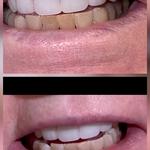 Brighter Smiles Cosmetic Teeth Whitening - photo 8