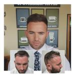 Capital Hair Restoration - Hair Transplant - photo 8