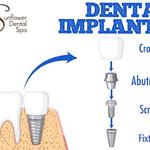 Sunflower Dental Spa - photo 4