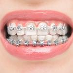 Willow Street Dental - photo 2