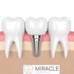 Miracle Dental Care - photo 1
