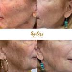 Ageless Aesthetics & Wellness - photo 3