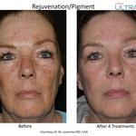 The Warren Med Spa - photo 3