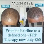 Moonrise Aesthetics - photo 2