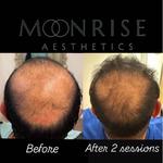 Moonrise Aesthetics - photo 5