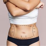 Liposuction in Islamabad - Health Club in Anantnag