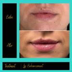 Prima Doll Aesthetics - photo 2