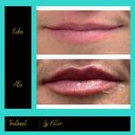 Prima Doll Aesthetics - photo 3