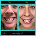 Prima Doll Aesthetics - photo 4