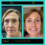 Prima Doll Aesthetics - photo 5