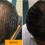 RAPAPORT HAIR INSTITUTE - photo 1