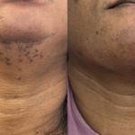 SkinPlus by Oroyo - photo 1