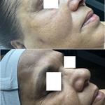 SkinPlus by Oroyo - photo 2