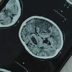 St Michael's Neurology - photo 5