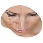 Luxe Dermato Esthétique - Dr Jacques Charbonneau Dermatologue - photo 2