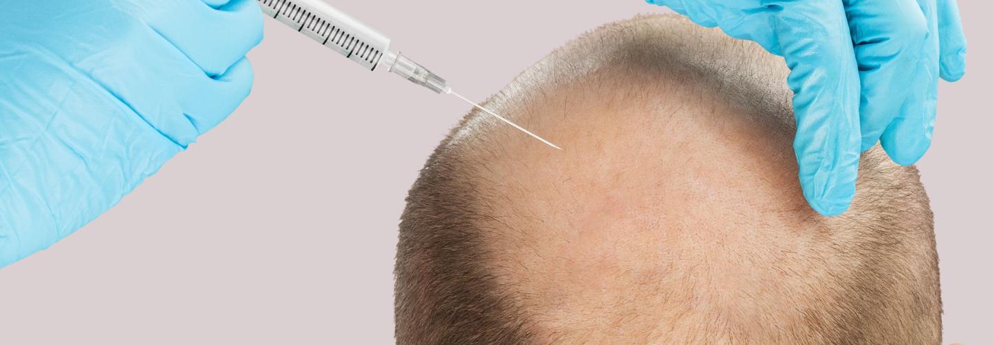Srinagar Hair Transplant cover photo