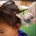 Lice Clinics of America - Lufkin - photo 4
