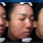 La Réserve Aesthetics Med Spa + Wellness - photo 5