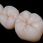 Smili Dental - Pine Centre Mall - photo 3