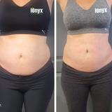 iOnyx Medspa & Wellness Club