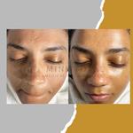 Mink Total Medical Spa & Wellness - photo 2