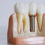 Dental Planet - Dental Clinic in Tellapur, Hyderabad - photo 4