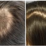 LIVE Hydration Spa 1488 - photo 3