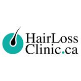 Hair Loss Clinic Toronto