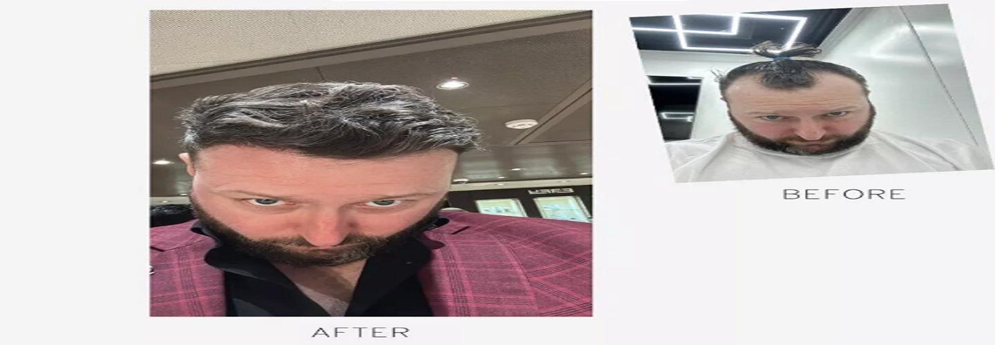 Harley Street Hair Transplant Clinic Manchester cover photo