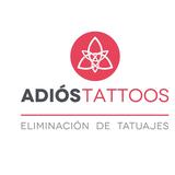 ADIÓS TATTOOS VALENCIA Centro Especializado en Eliminación de Tatuajes