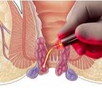 Dr. K. Balu Advance Laparoscopic Robotic Surgeon and LASER Proctologist - photo 3